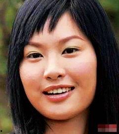 香港女明星 整容